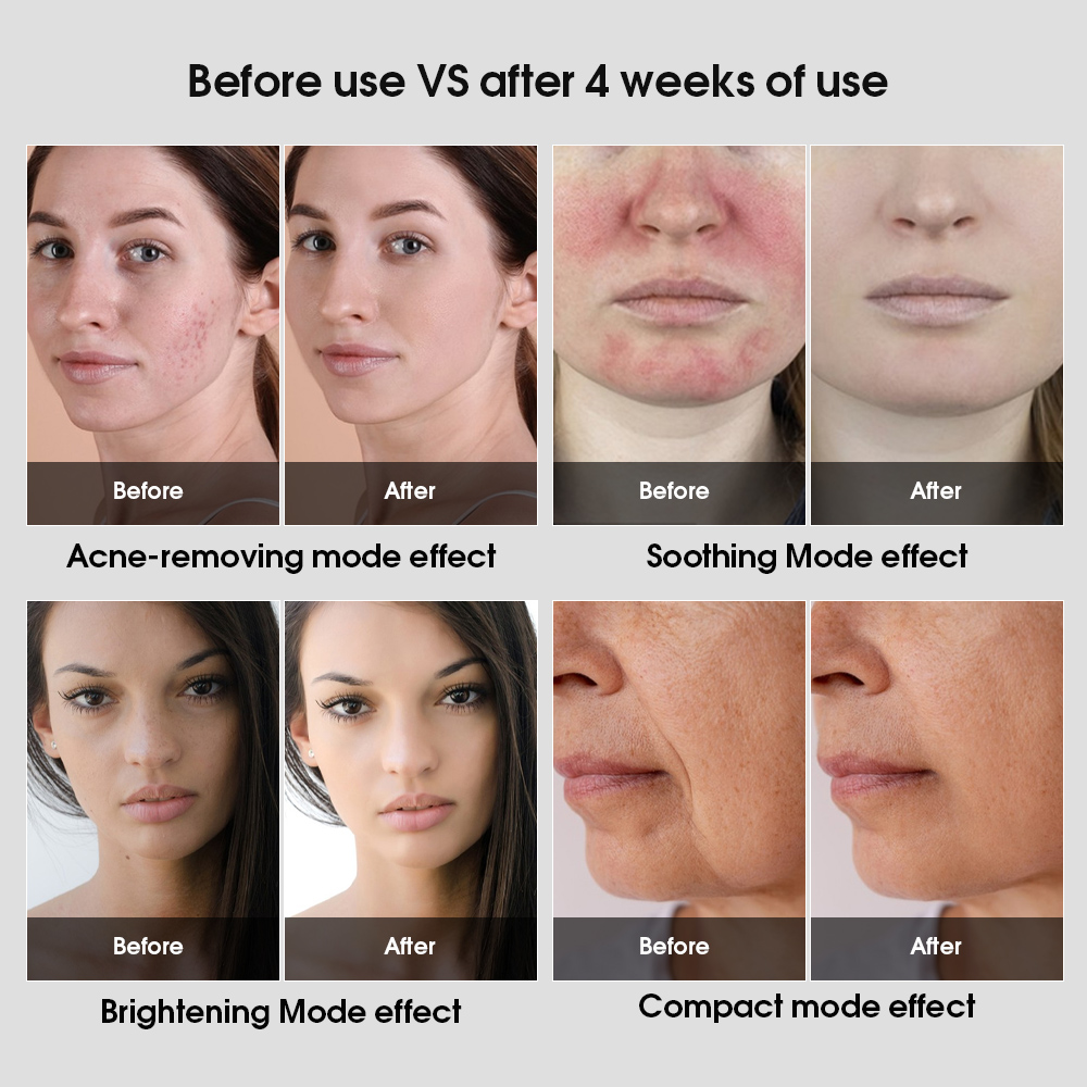 Профессиональная 5-цветная светодиодная светотерапевтическая панель 10 мм ультра тонкая для клиник и спа-центров